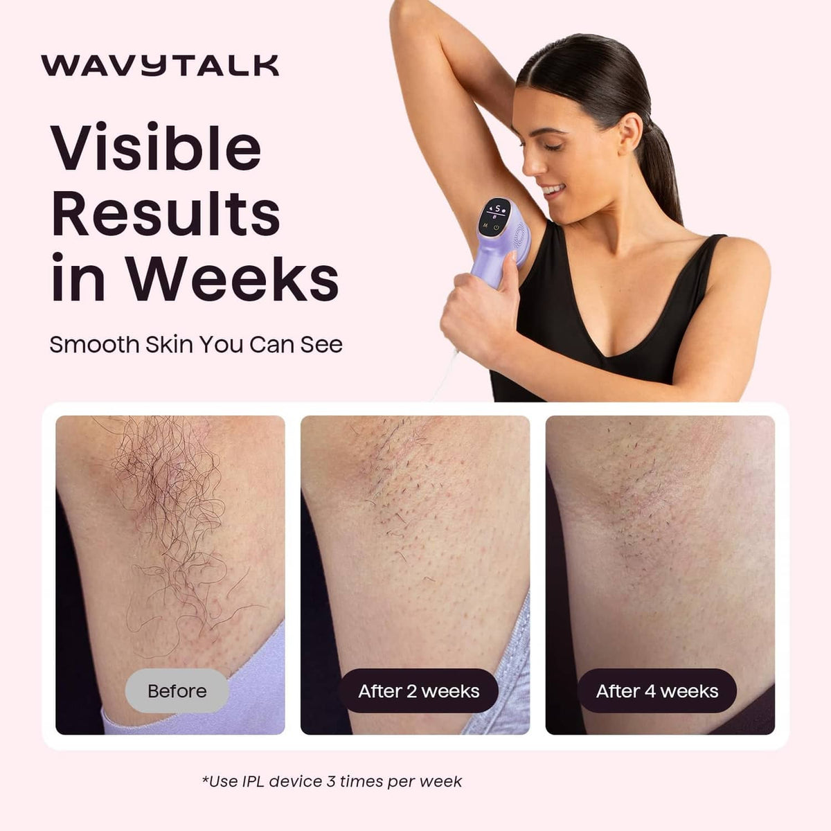 Wavytalk purple IPL hair removal device held against forearm