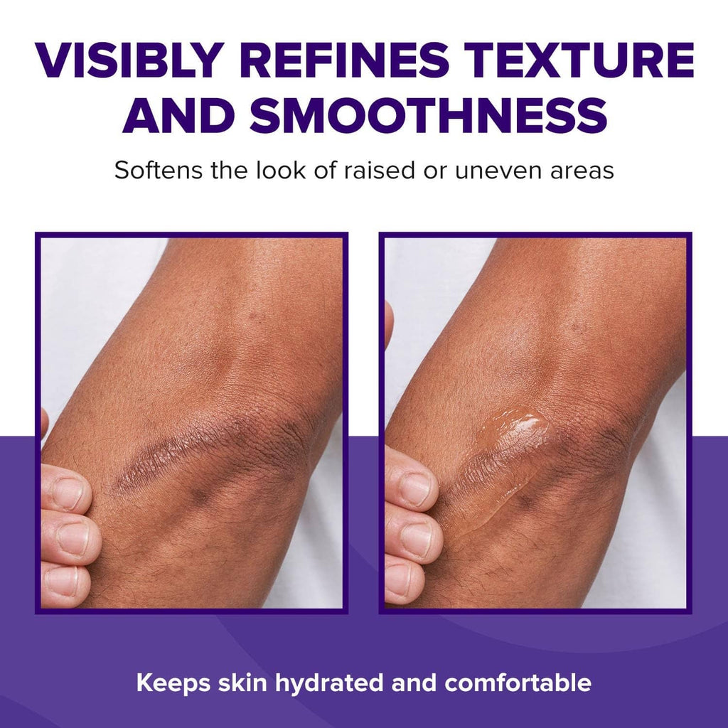 Silicone scar gel applied to skin on an arm with a glossy, smooth layer