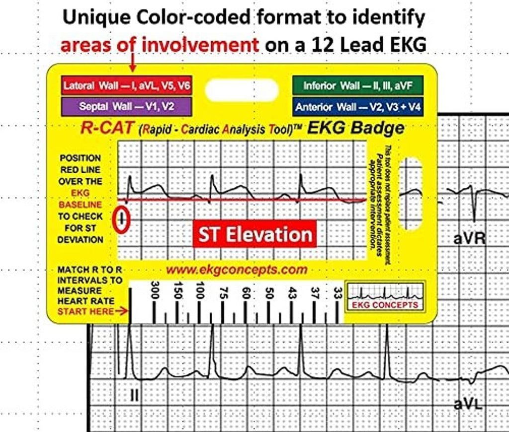 EKG analysis badge, yellow card with color-coded zones for 12-lead EKG identification