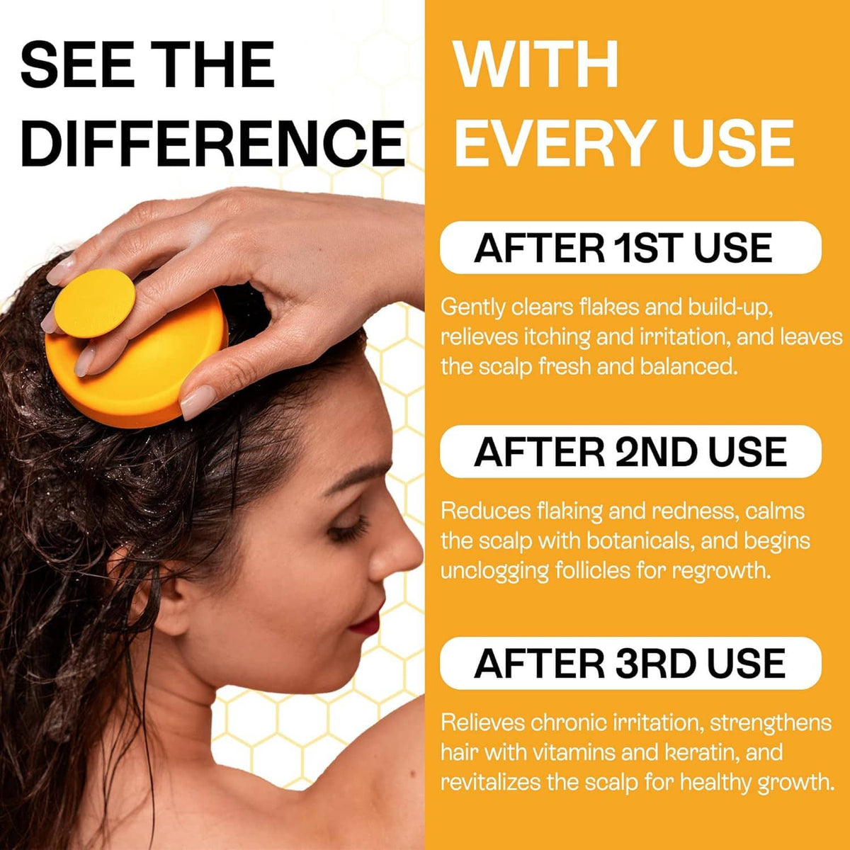 Salicylic acid scalp shampoo application with yellow cleansing pad on hair