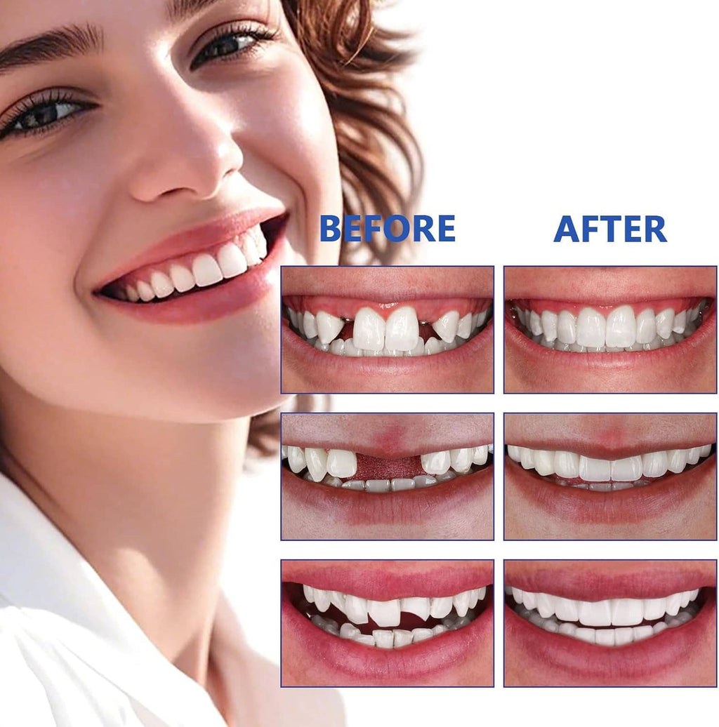 Moldable false teeth before-and-after smile collage with close-up teeth comparison