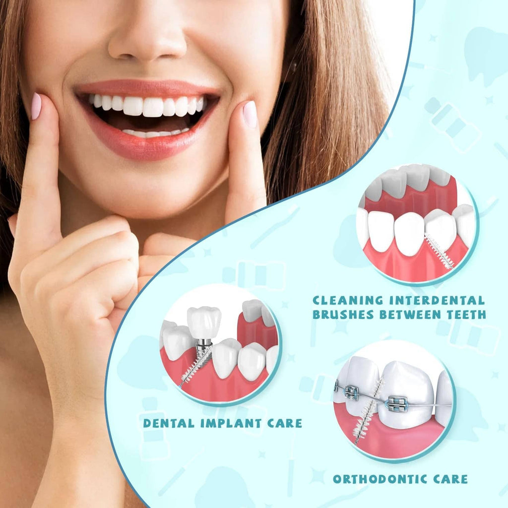 Interdental brush shown cleaning teeth with braces and dental work