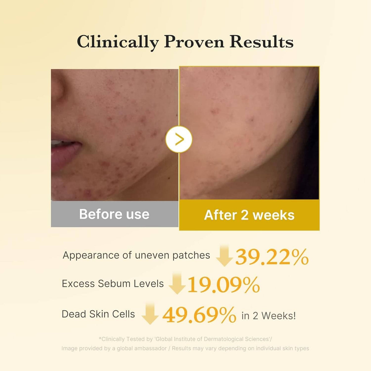Before-and-after skin results chart for Kojic Acid Turmeric Pad