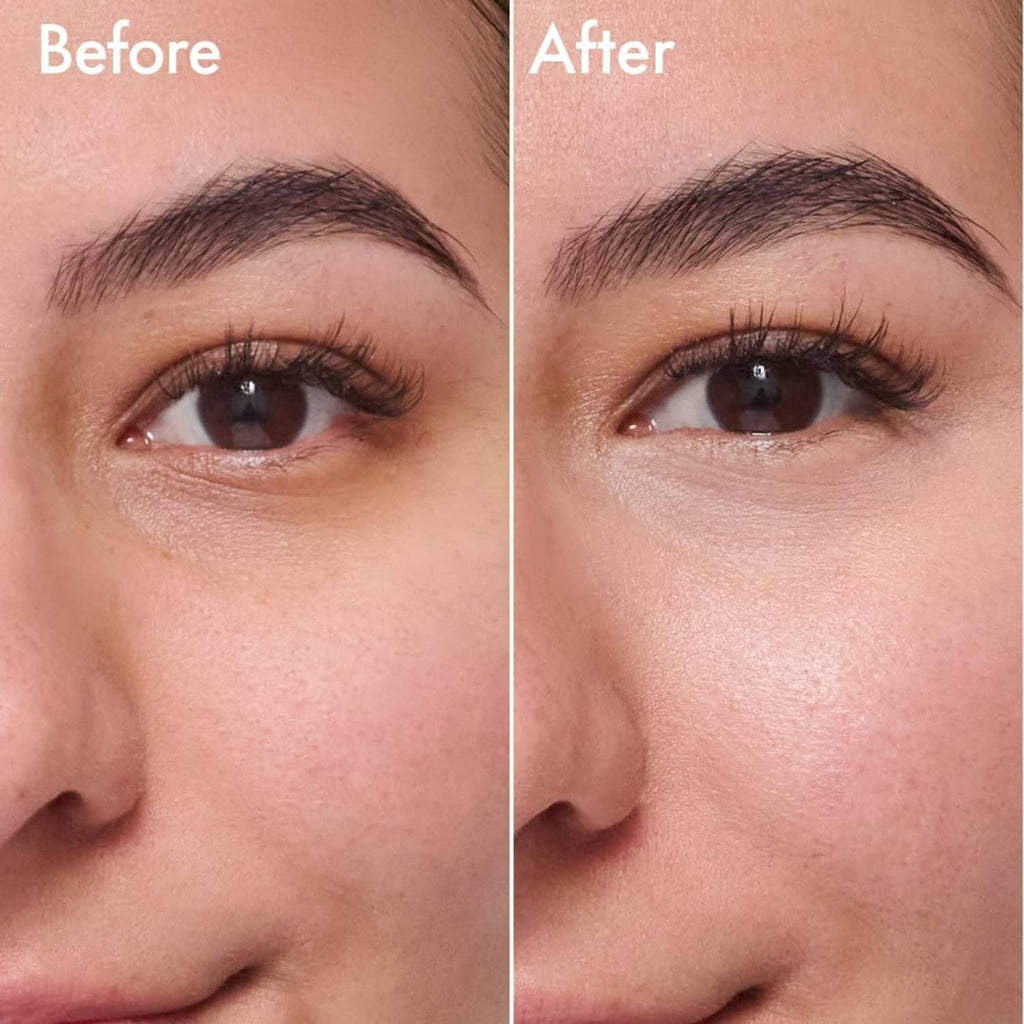 Under-eye brightening results shown with before-and-after light rose tint