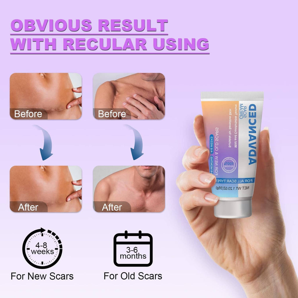 Silicone scar gel tube with before-and-after result panels and usage timing icons