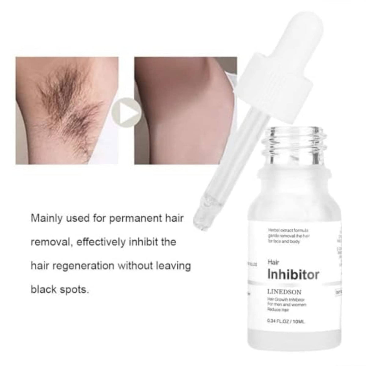 Hair growth inhibitor serum bottle with dropper and inset skin hair-removal area