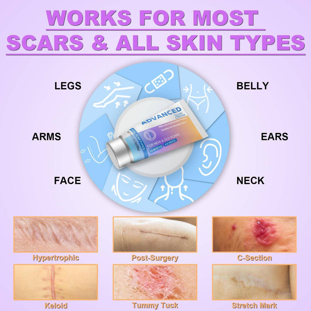 Silicone scar gel tube in center with coverage areas diagram for scars and skin types
