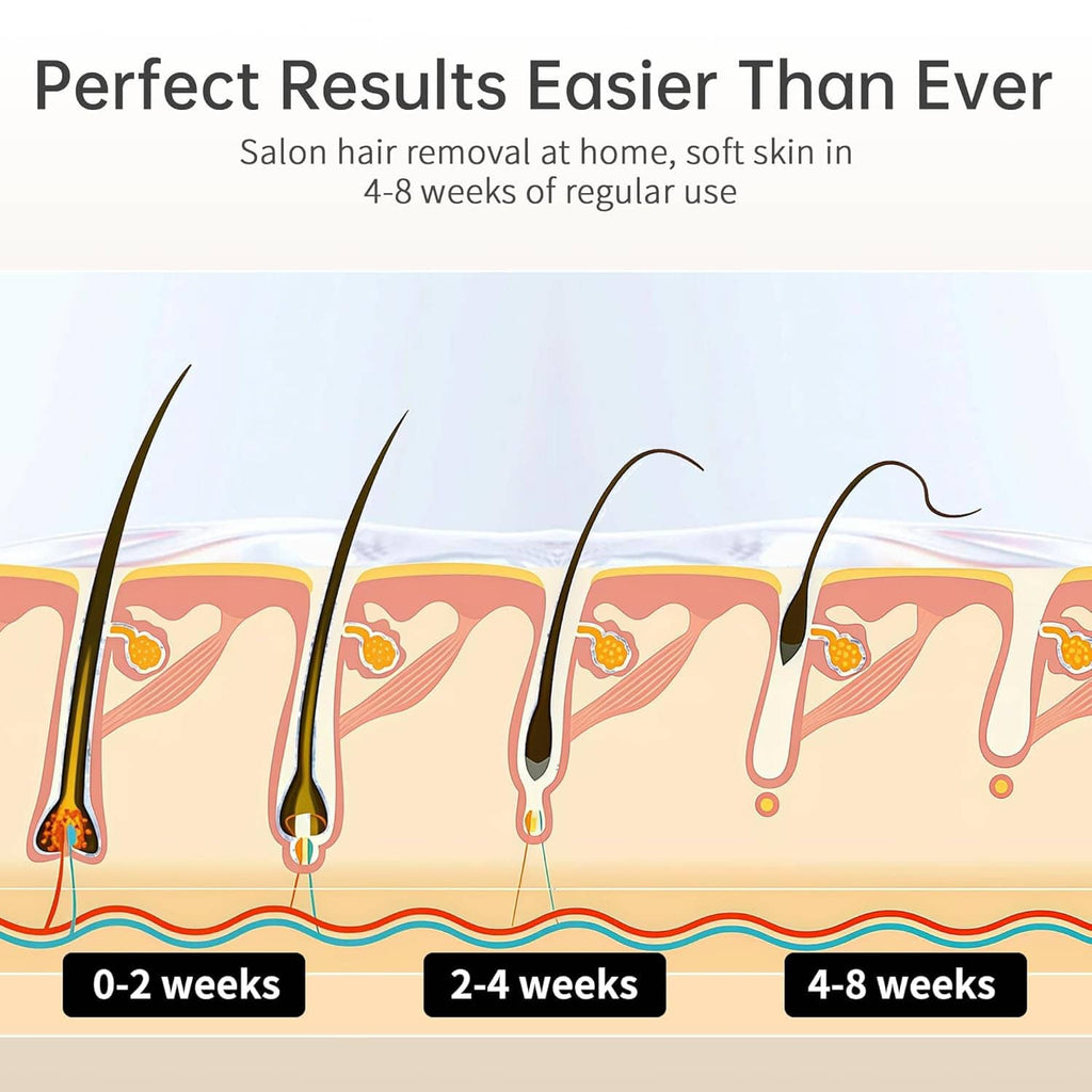 Hair removal progress diagram with skin and treated hair growth timeline