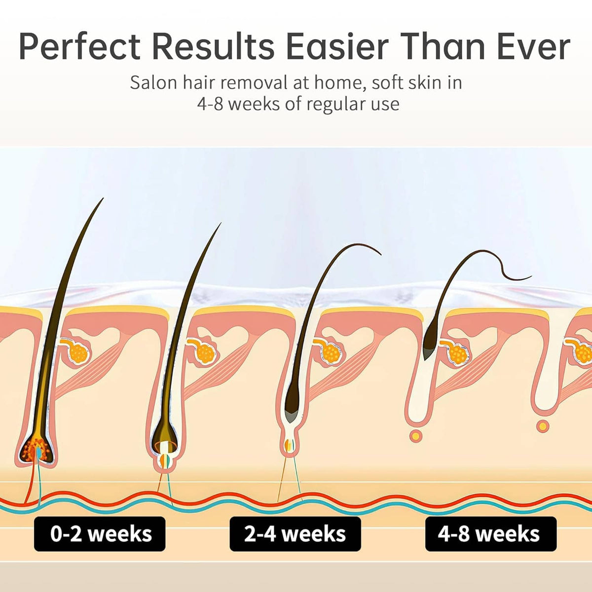 Hair removal progress diagram with skin and treated hair growth timeline