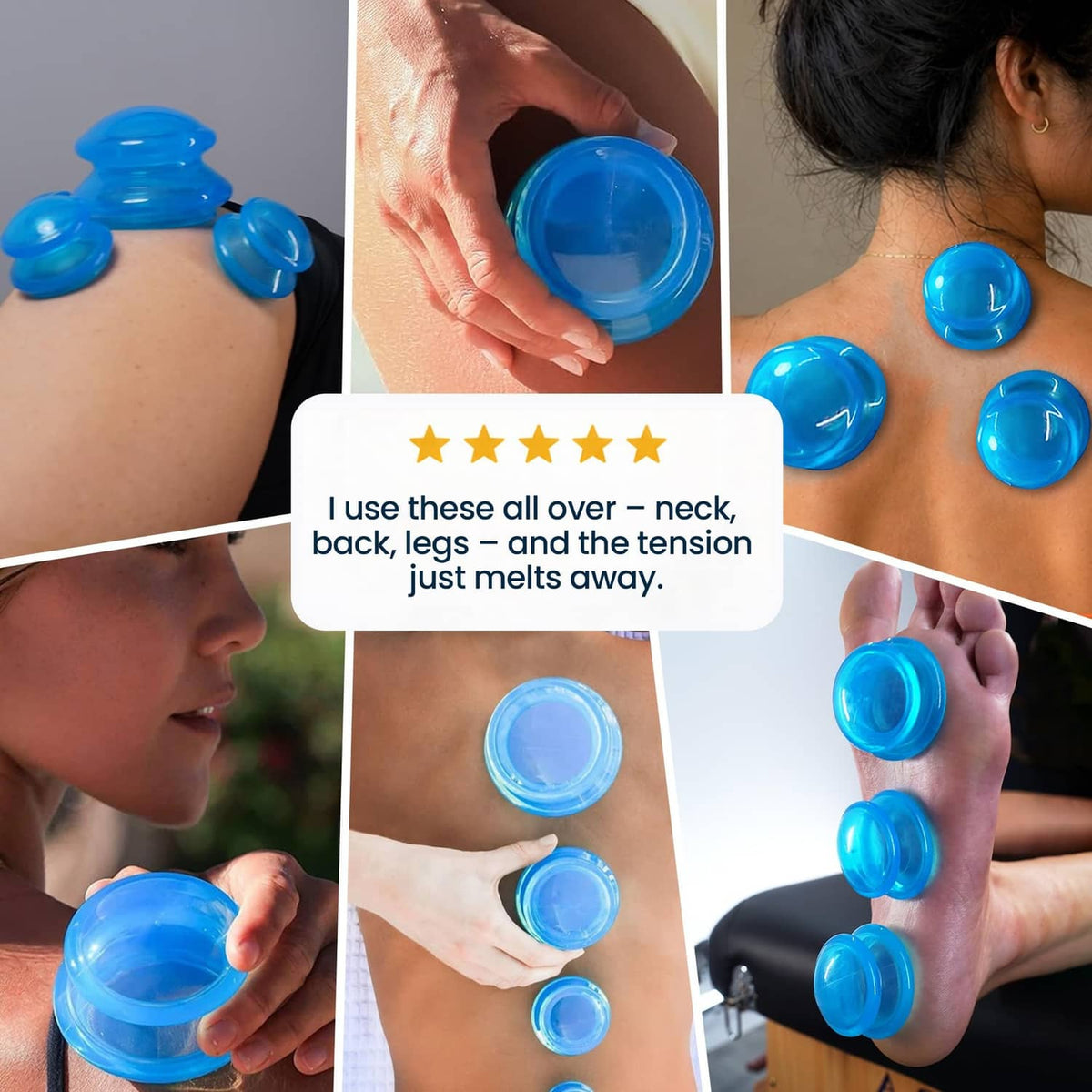 Blue silicone cupping cups on neck and shoulders, with multiple cup placements