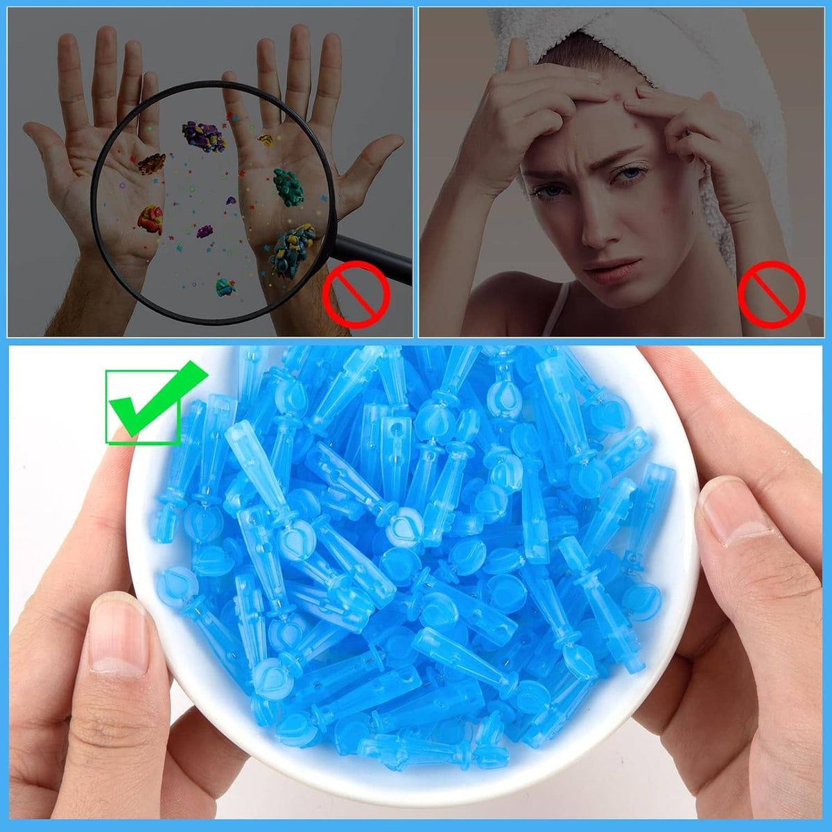 Blue disposable acne lancets with needle tips shown in a white bowl