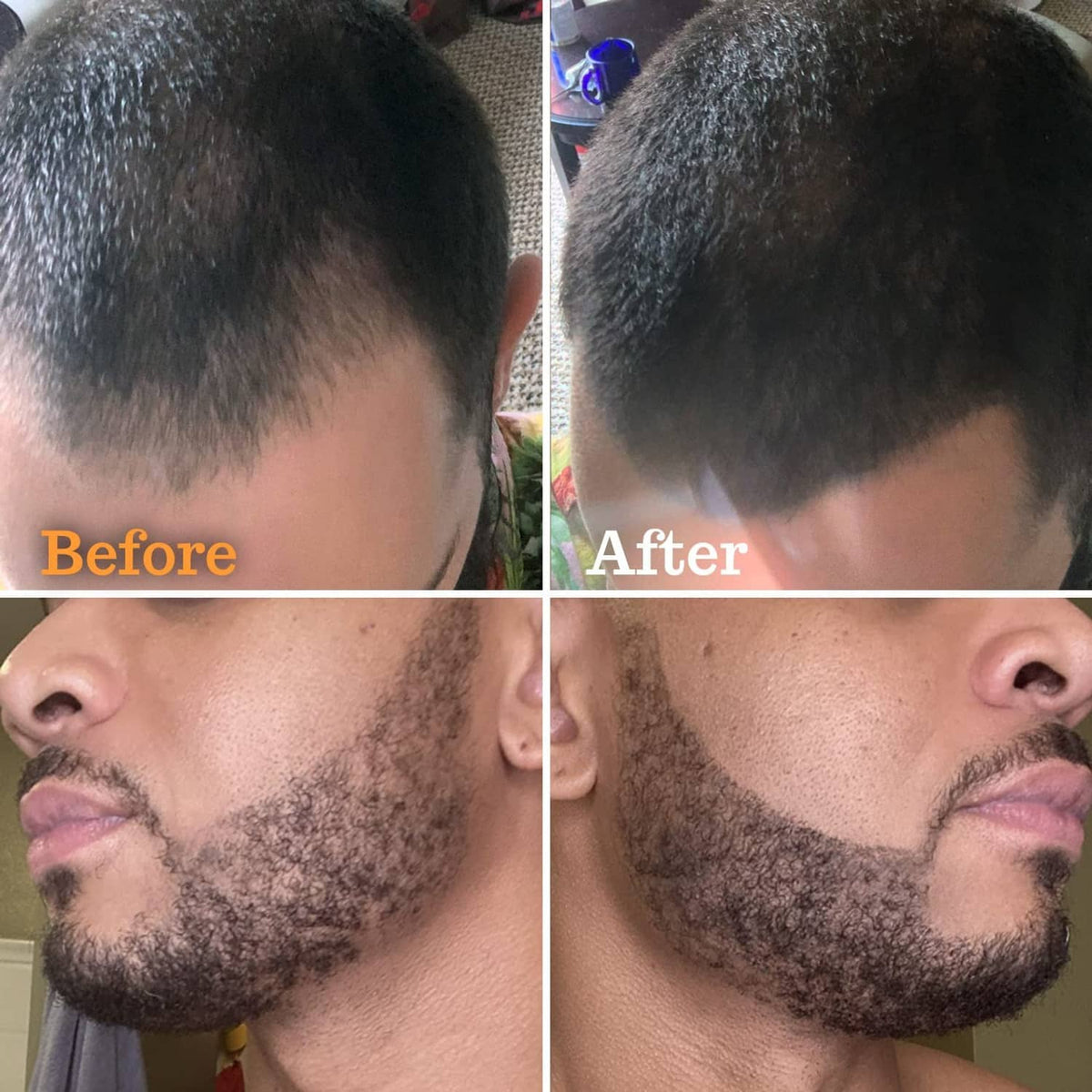Men's beard with filled-in patches and smoothed neckline after styling