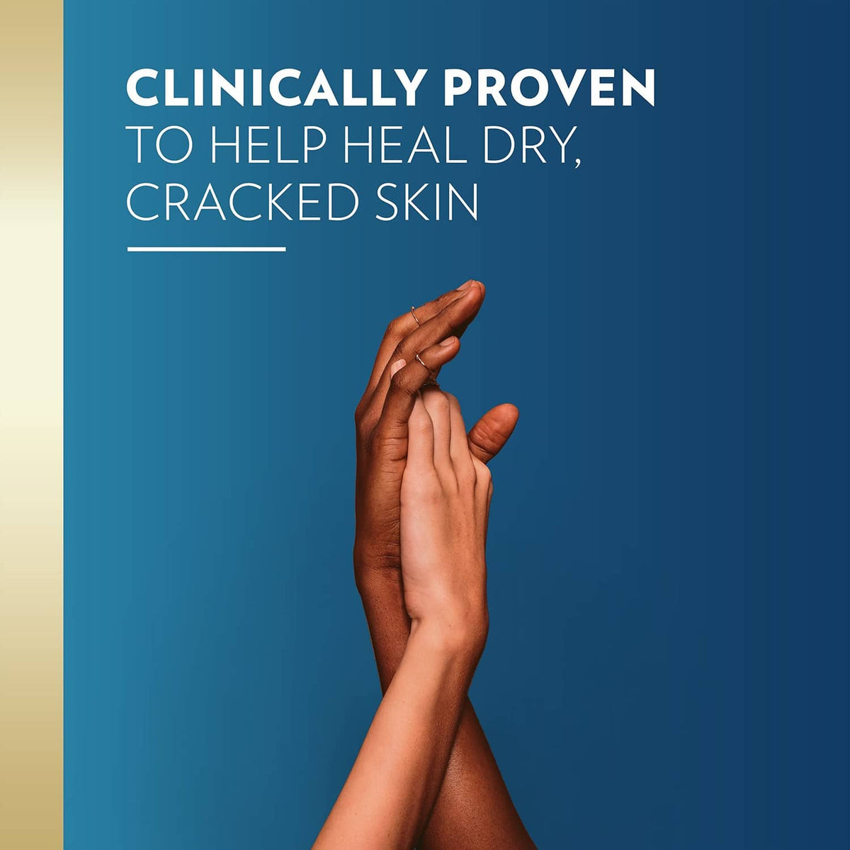Hands applying Vaseline petroleum jelly for dry, cracked skin