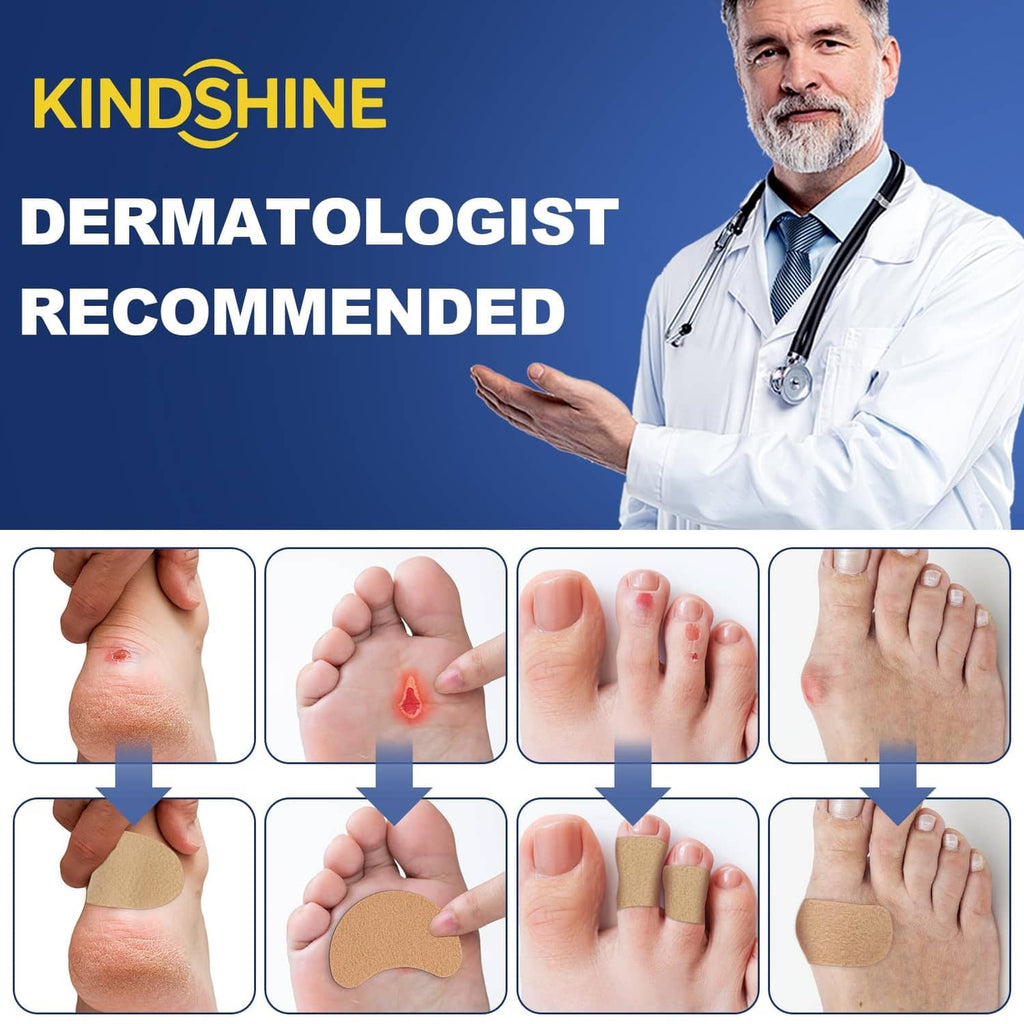 Beige moleskin adhesive padding strips applied to feet for blister relief