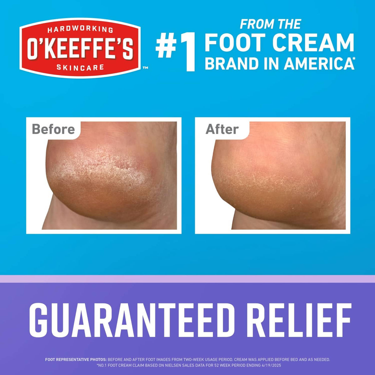 Night treatment foot cream shown with before-and-after foot results