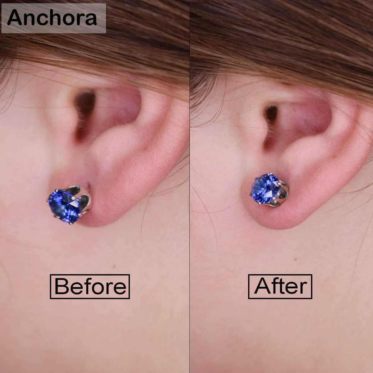 Before-and-after ear photo showing a blue stud earring with improved fit