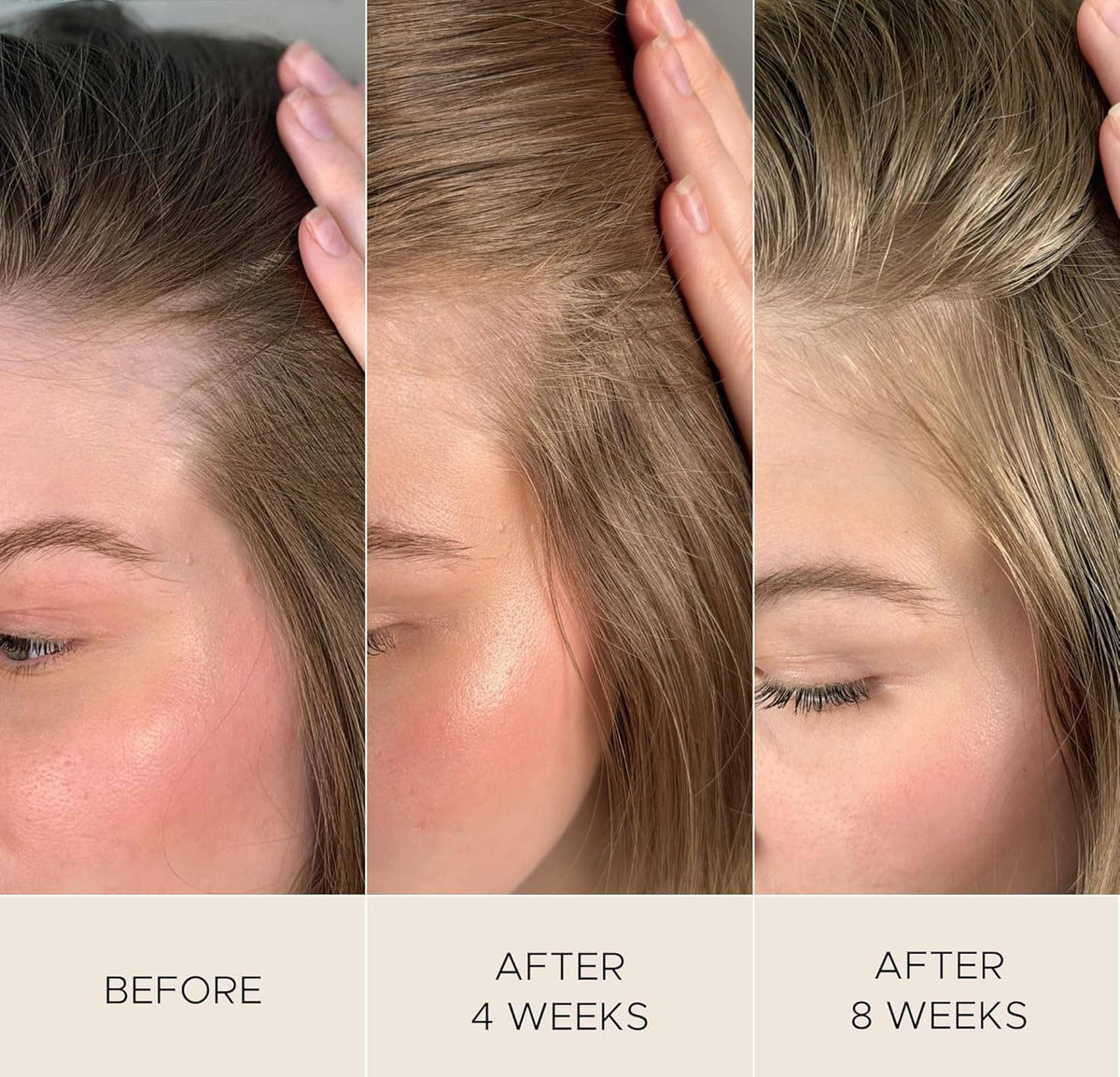 Close-up scalp and hairline with hands pressing serum, shown in three panels