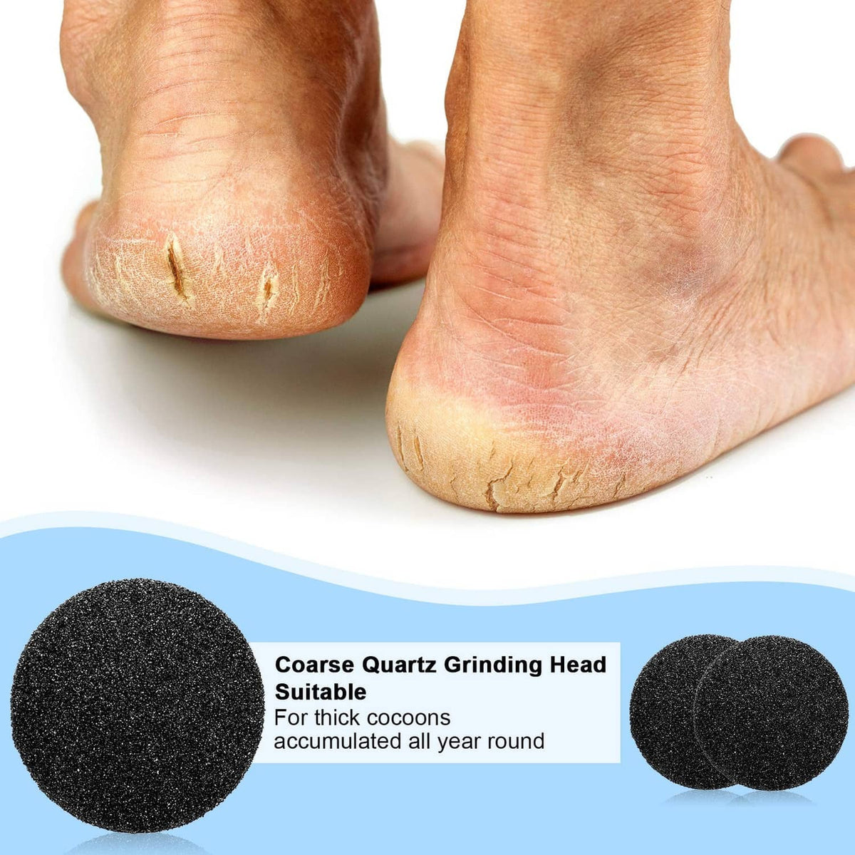 Coarse abrasive grinding heads: round black replacement pads for foot grinder