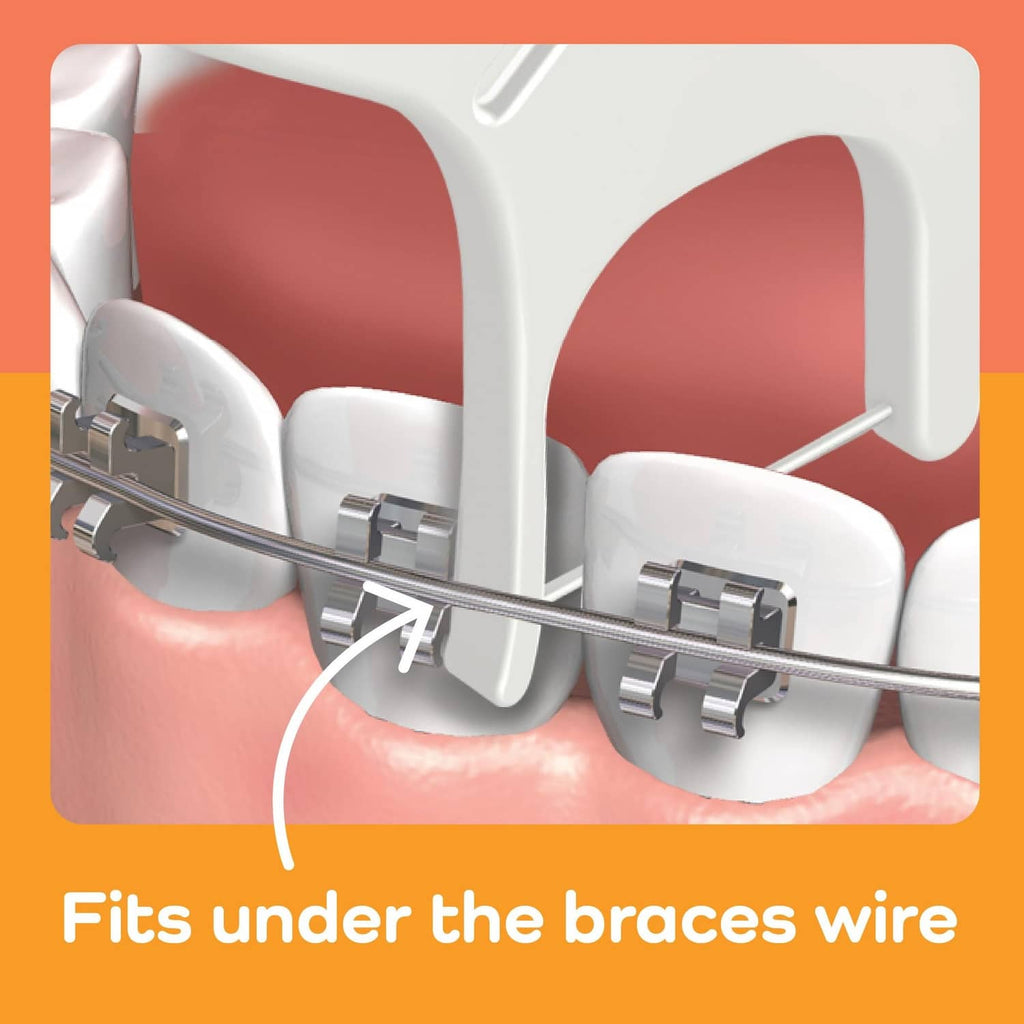 Floss pick shown fitting under braces wire, between metal brackets