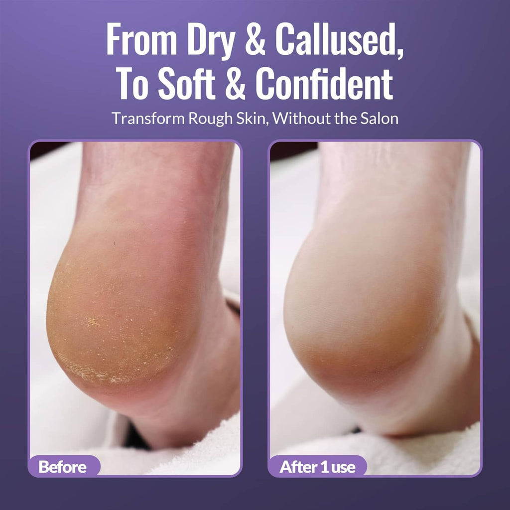 Heels with callus softener spray bottle and stainless-steel foot file