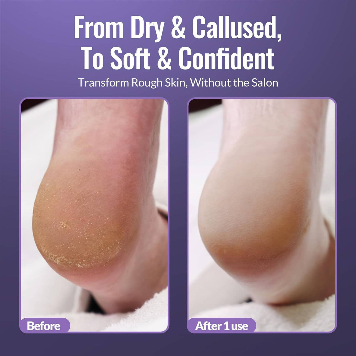 Heels with callus softener spray bottle and stainless-steel foot file