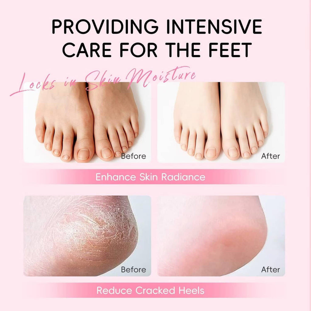 Before-and-after feet heel care illustration for cracked heels using heel stick