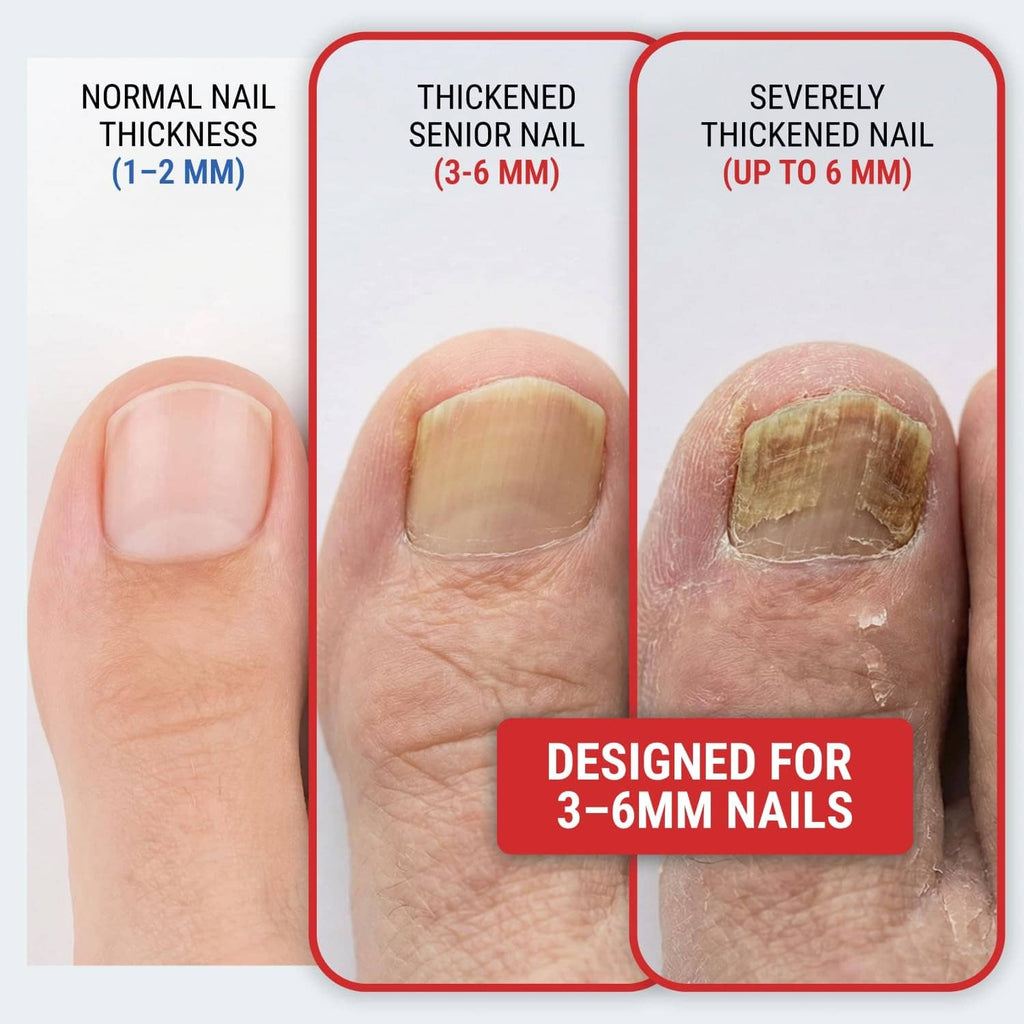 Black KLIPP toenail clipper designed for 3–6 mm thickened toenails