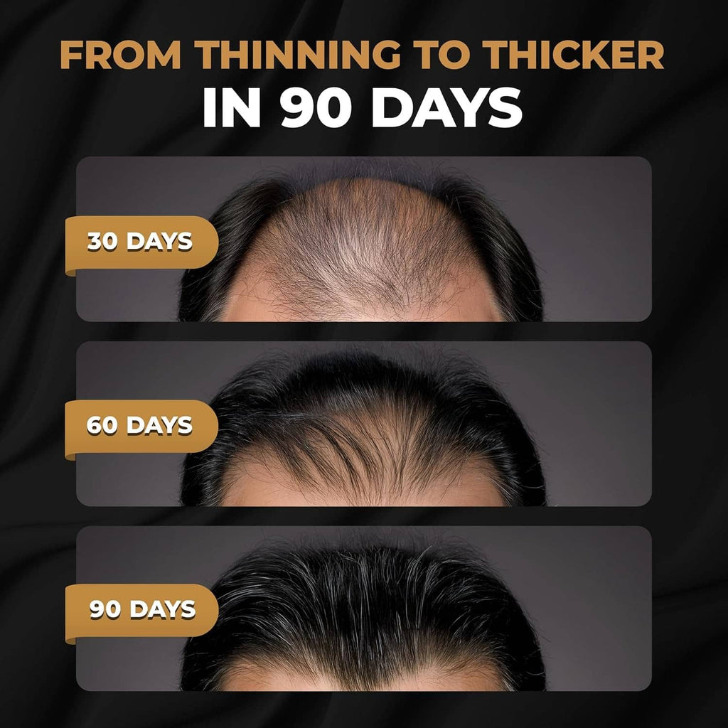 Hair growth progress banner with 30, 60, and 90 day panels