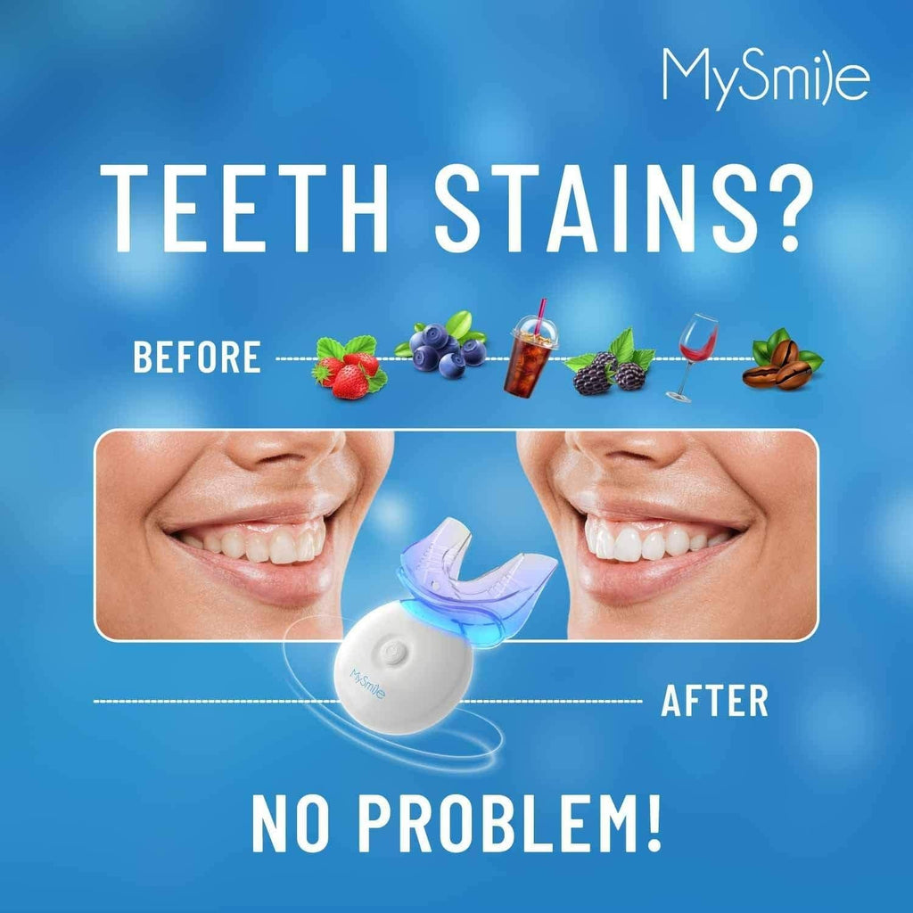 Teeth whitening kit with LED mouth tray and gel applicator shown beside smile