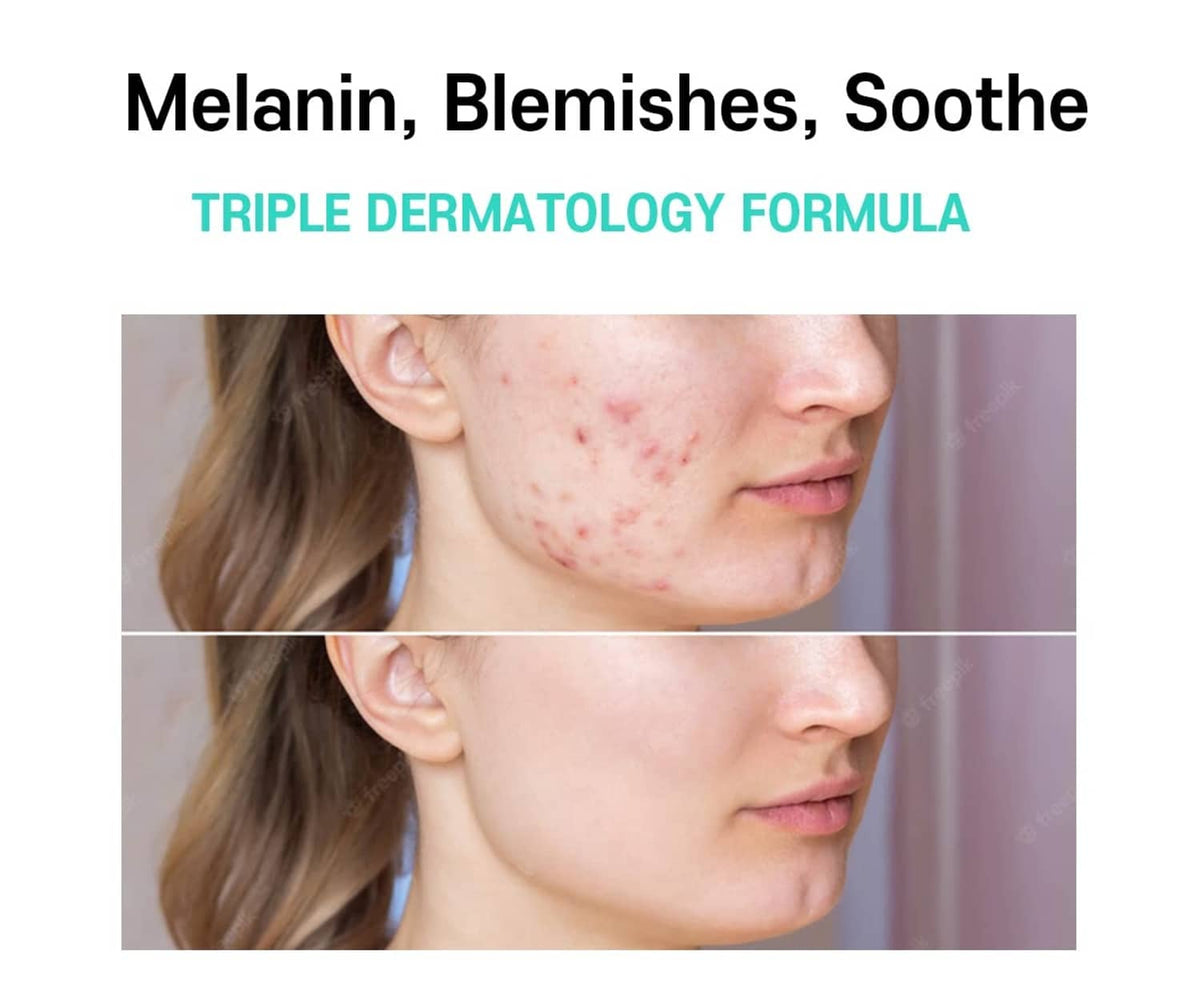 Before-and-after skin photo showing blemishes on cheek in face cream infographic