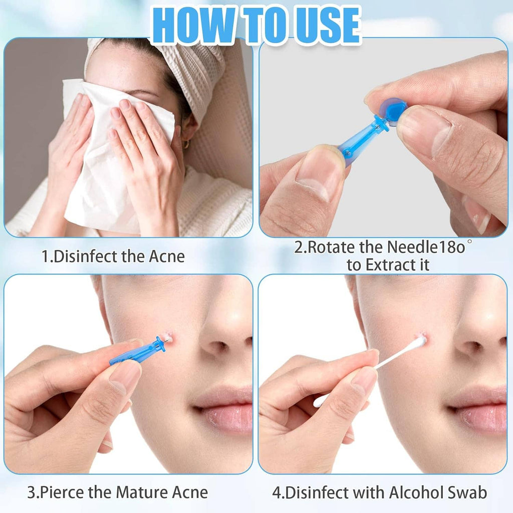 Disposable acne lancet kit with needle tool and steps for preparation shown