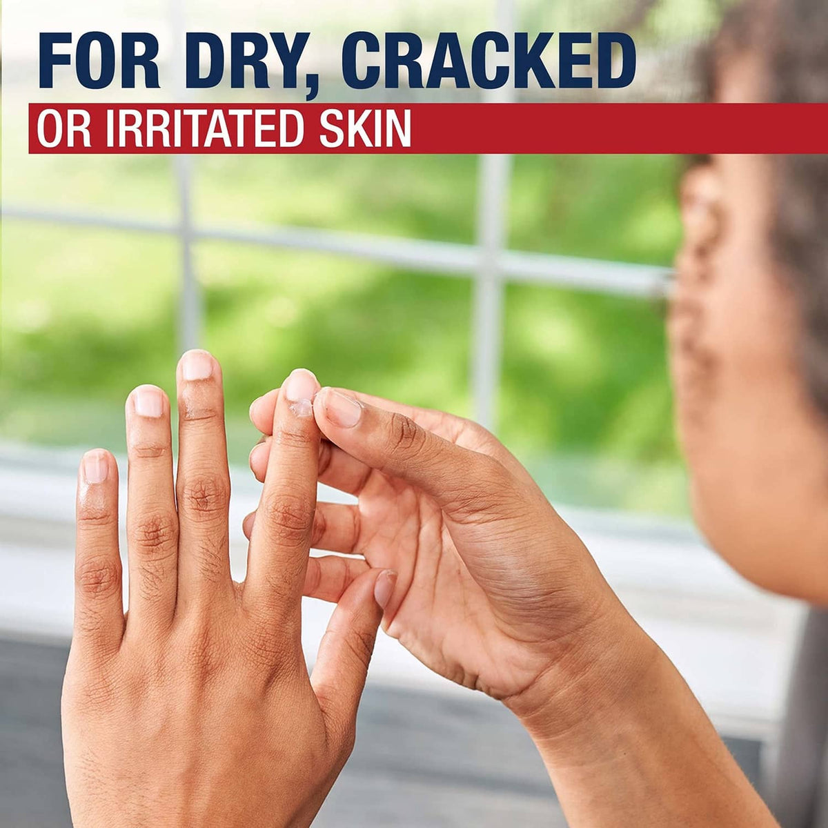 Aquaphor healing ointment for dry, cracked, or irritated skin—hands applying