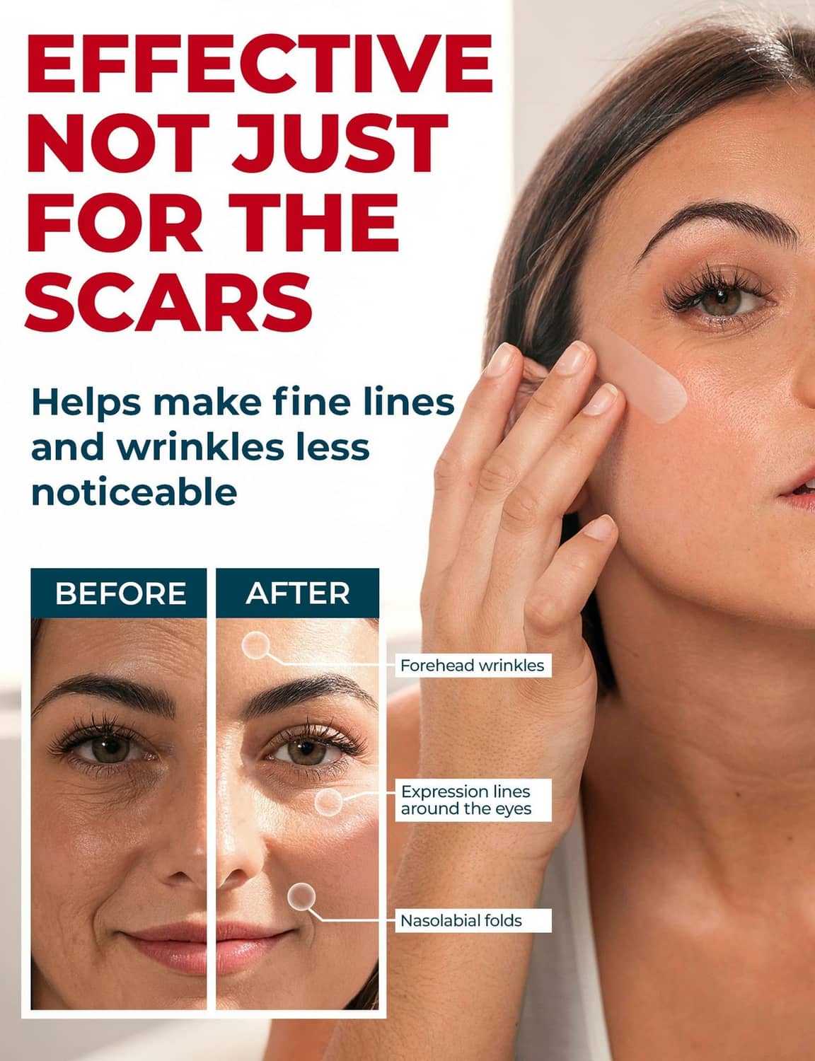 Beige silicone scar tape applied near eye area on a woman’s face