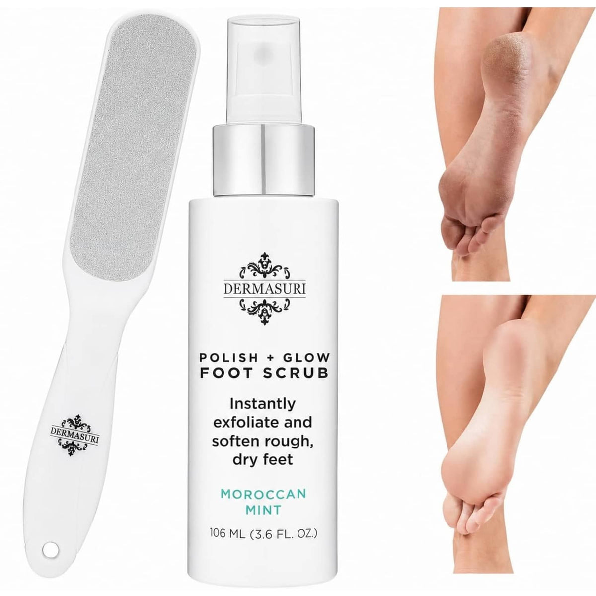 Foot scrub bottle and dual-sided foot file kit with gray abrasive pads and white spray top