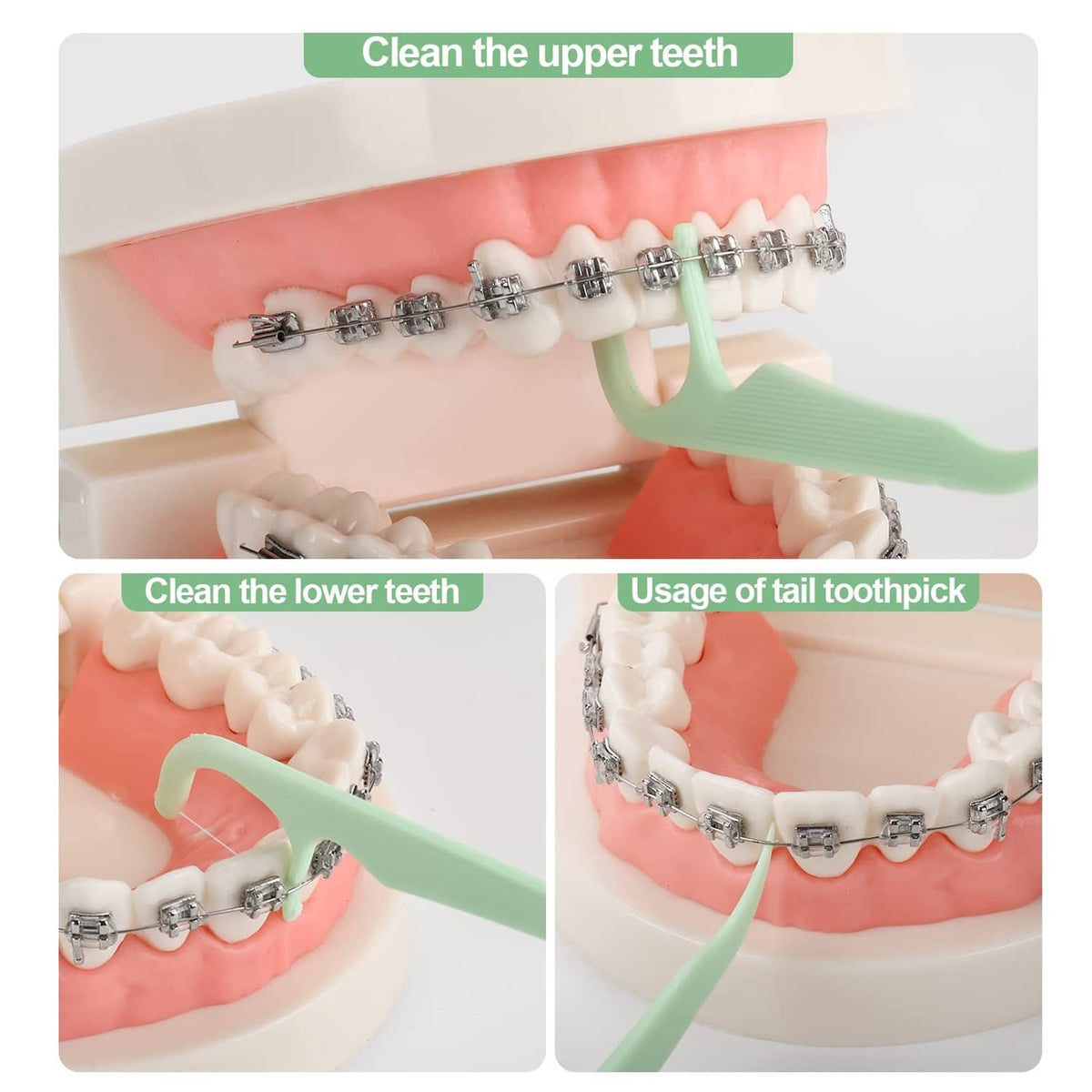 Orthodontic flosser cleaning upper and lower braces on a dental model