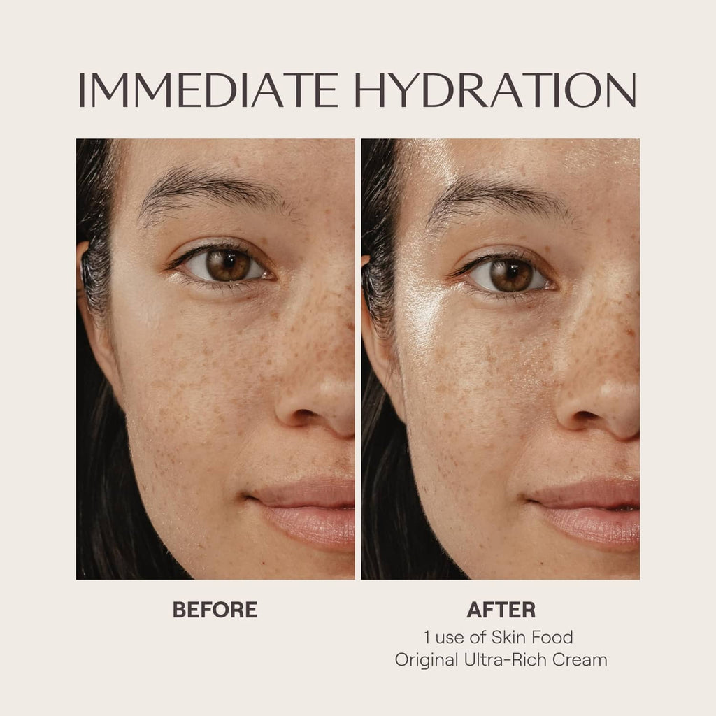 Before and after facial hydration using ultra-rich cream