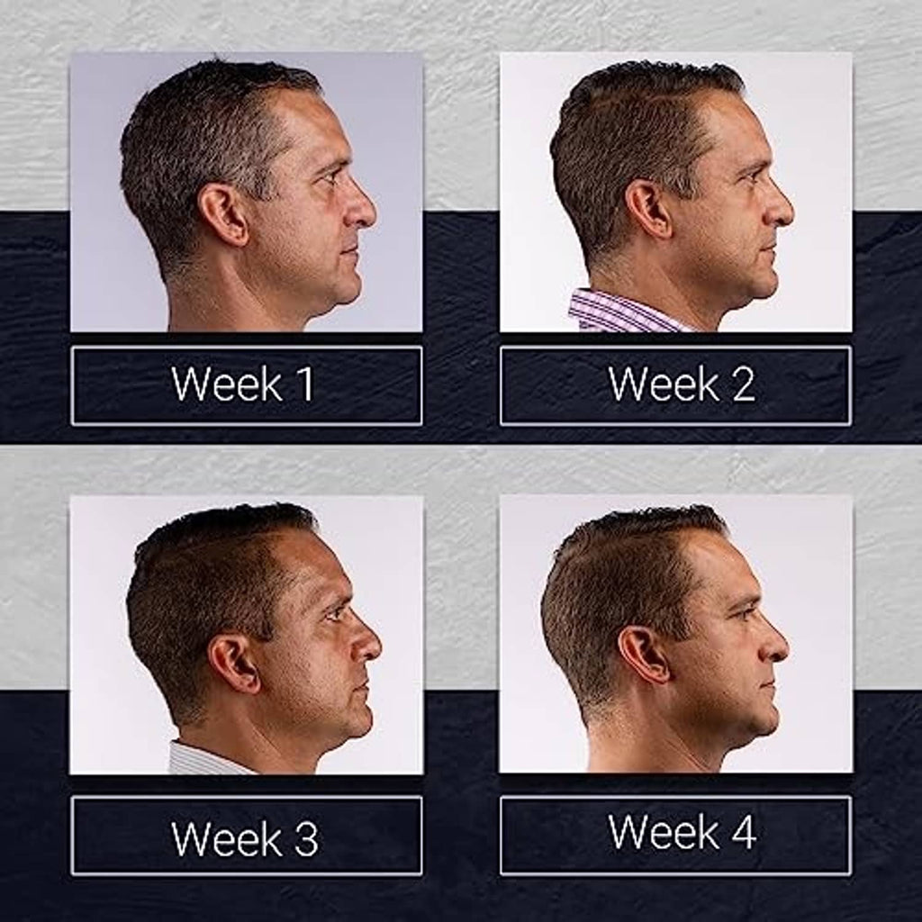 Hair conditioning results photo: side profile of man with week 1–4 comparison