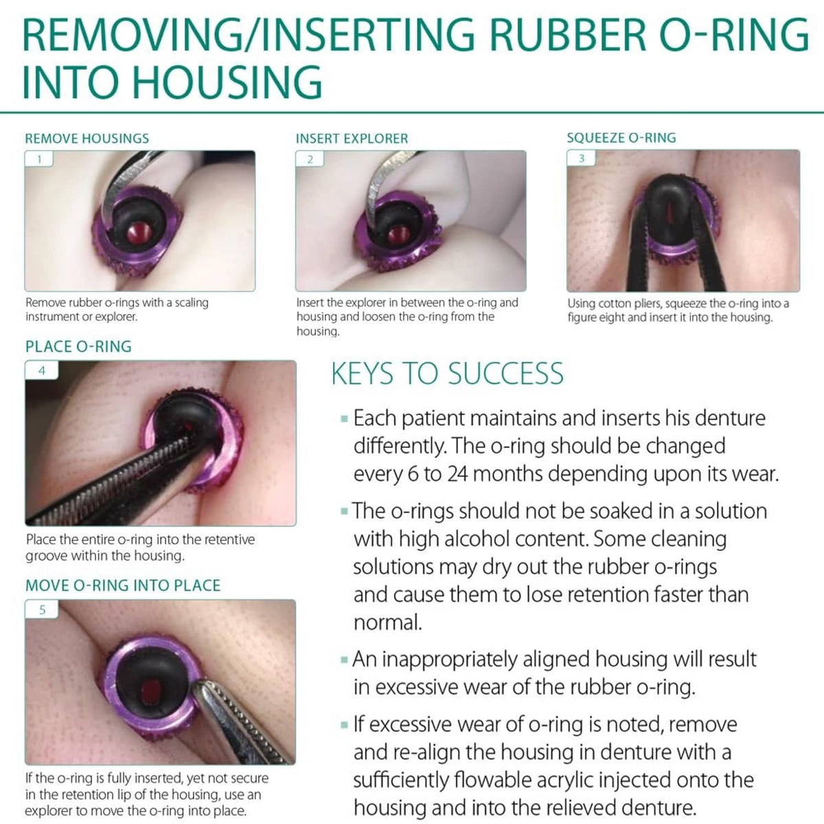 Instruction diagram for removing and inserting rubber O-rings into implant housing