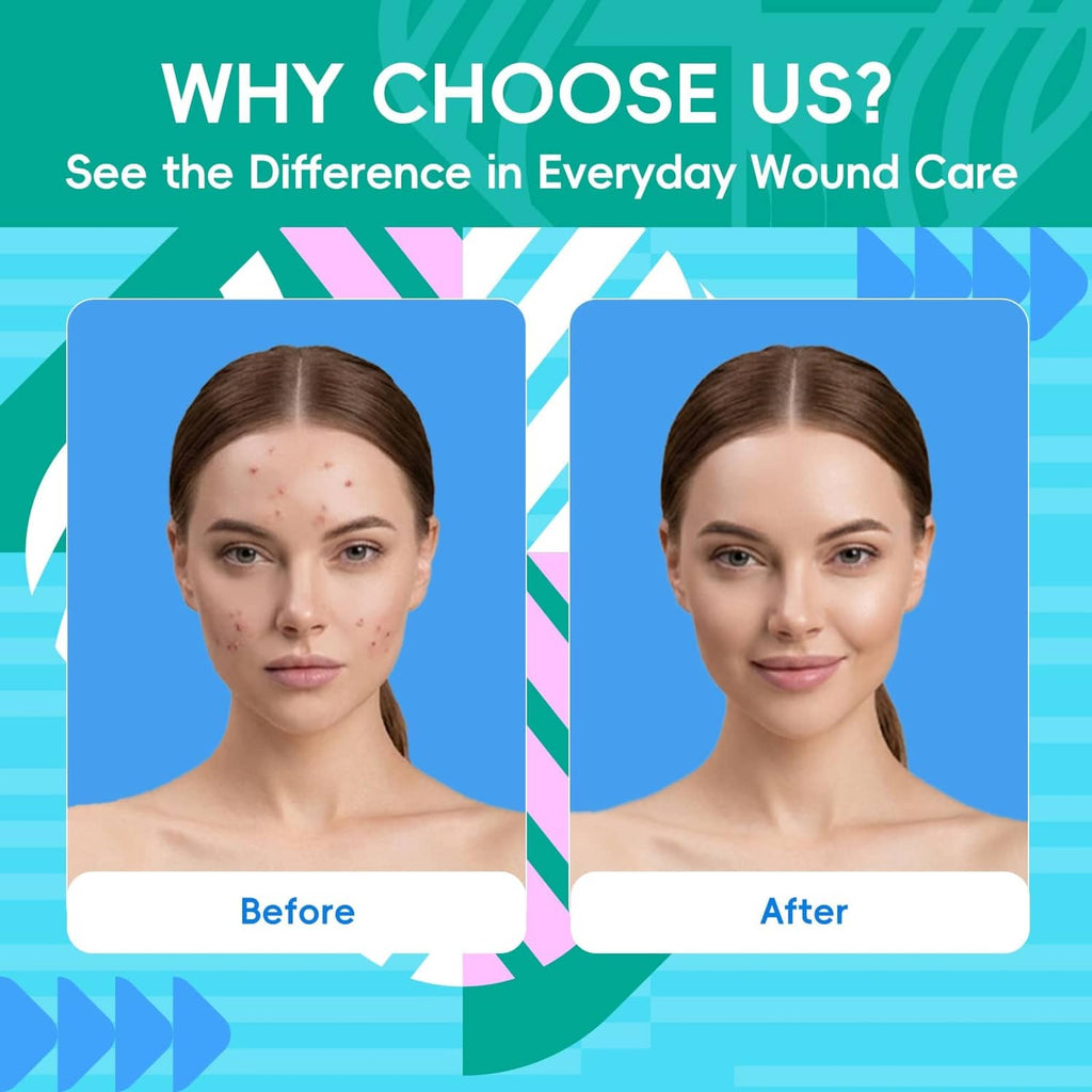 Hydrocolloid roll everyday wound care infographic with before-and-after faces
