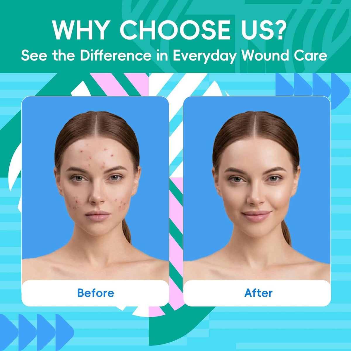 Hydrocolloid roll everyday wound care infographic with before-and-after faces