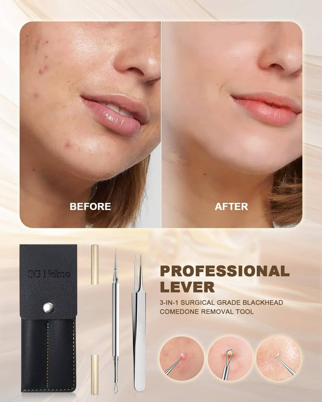 Facial pore extraction tool set with case and tips shown with before-and-after