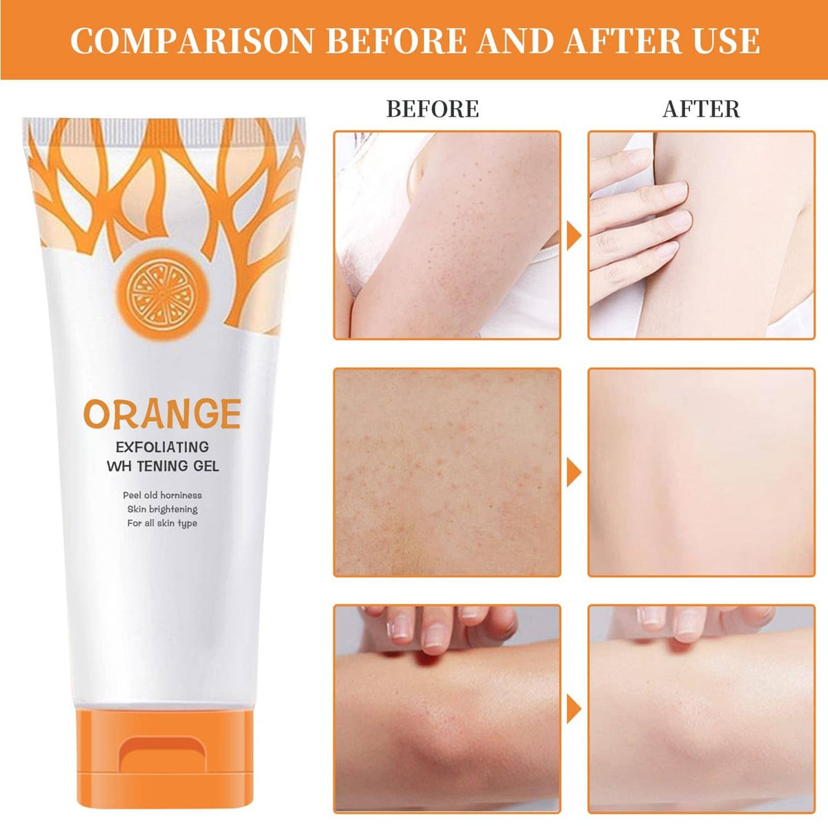 Orange exfoliating gel scrub tube with before-and-after skin comparison panels