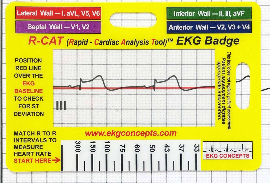 EKG analysis badge, bright yellow card with red waveform and measurement markings