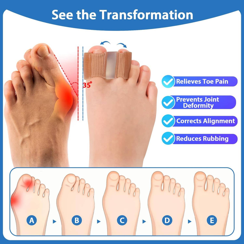 Toe separator worn between toes, tan sleeves with gel spacer to help align and reduce rubbing