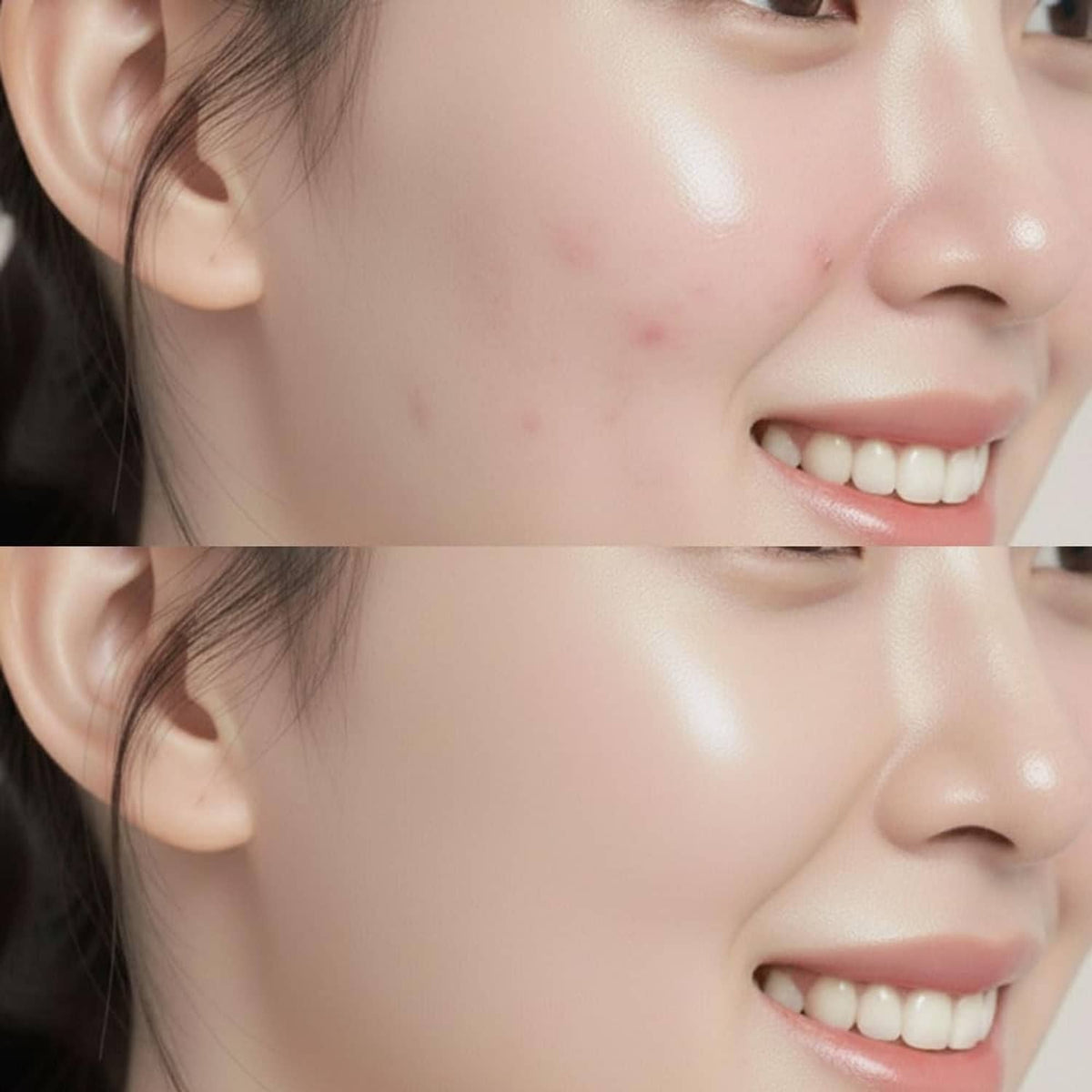 Brightened complexion on smiling face with smooth, even-looking skin