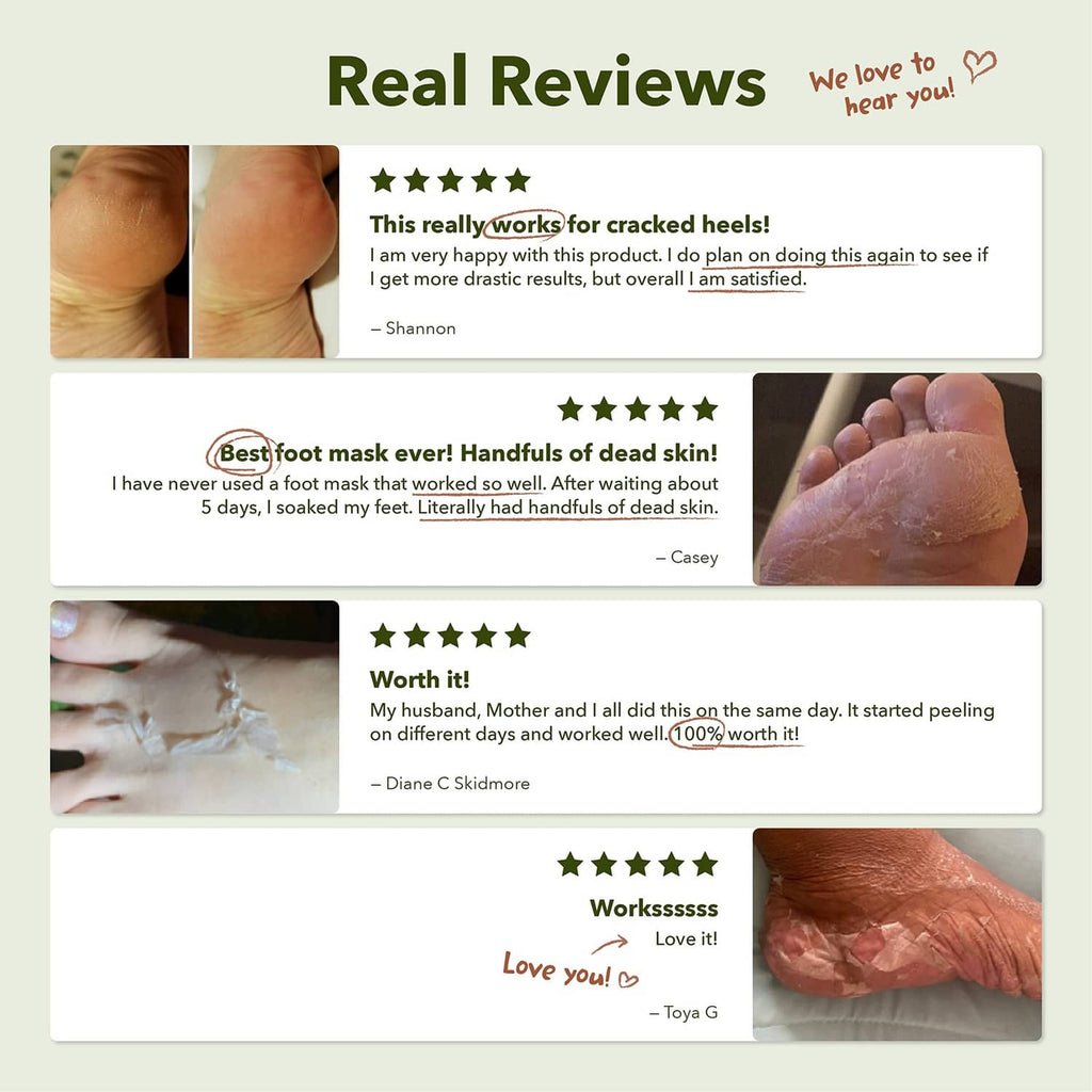 Customer review panel with close-up feet showing peeling mask results
