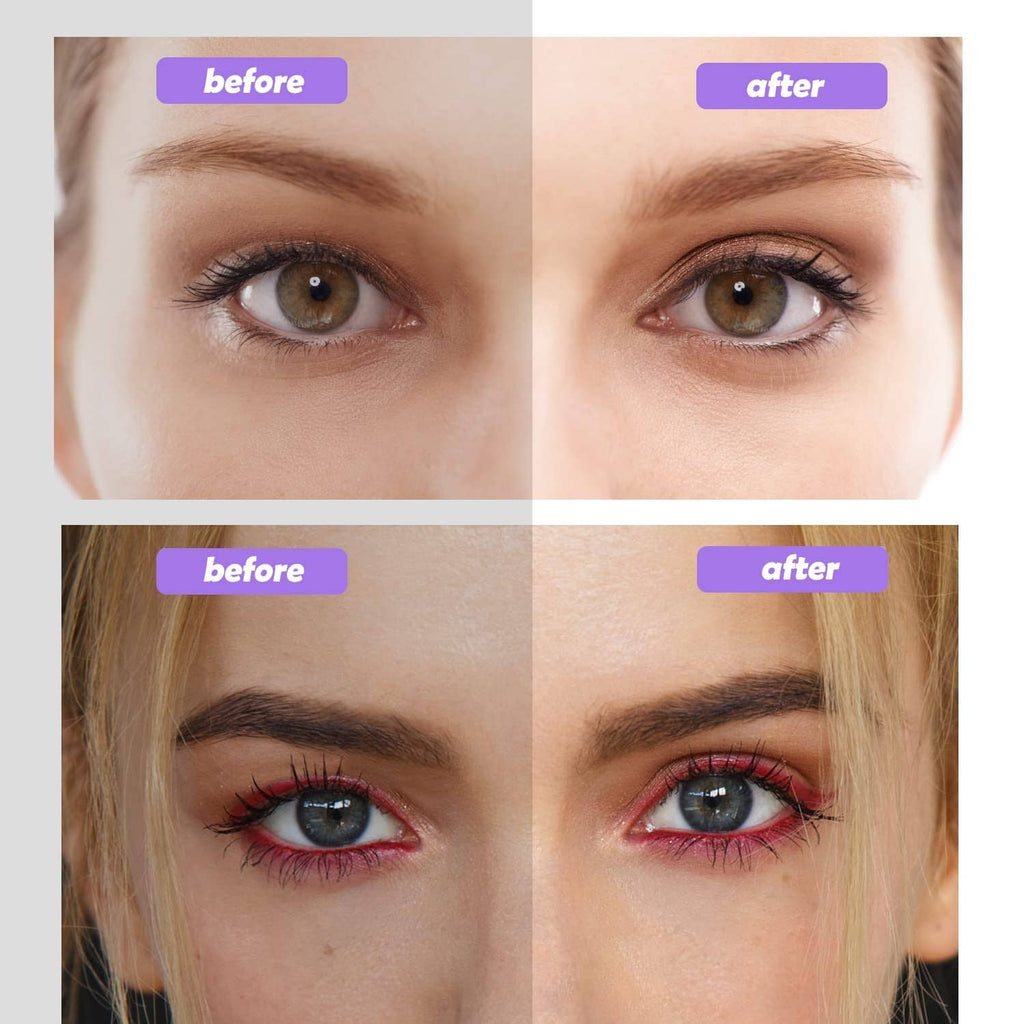 Eyelid tape used to lift upper eyelids, shown in before-and-after eye photos