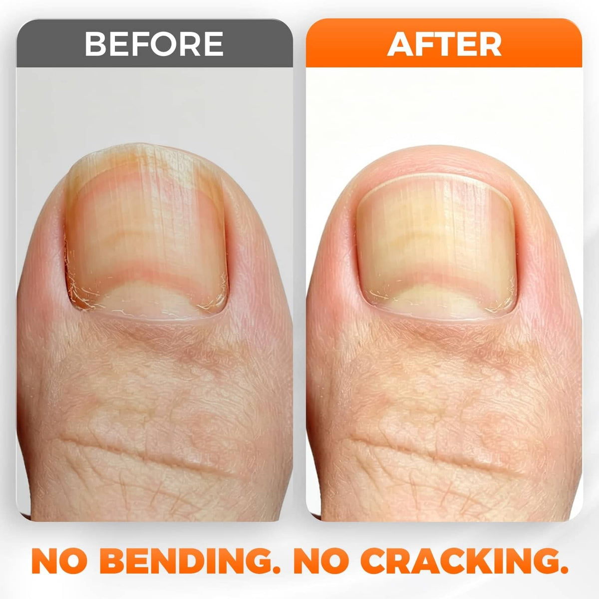 Before-and-after view of trimmed toenail with no bending or cracking