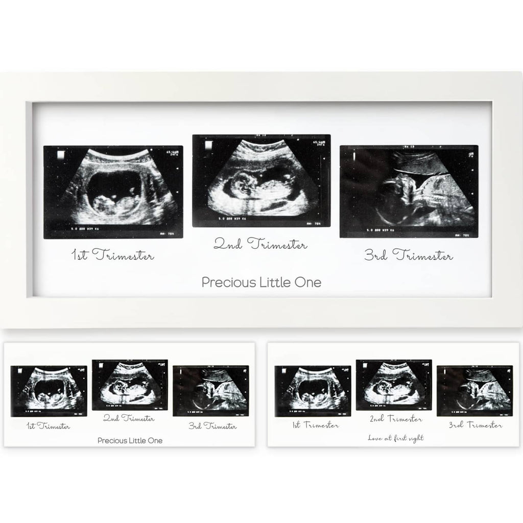 White ultrasound picture frame with three sonogram cut-outs for first, second, third trimester