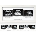 White ultrasound picture frame with three sonogram cut-outs for first, second, third trimester